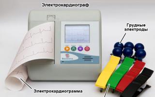 Normál EKG-átirat